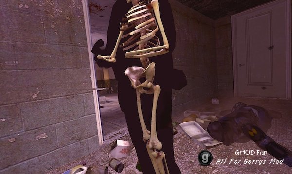 X-Ray Killcam