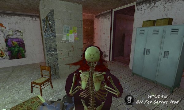 X-Ray Killcam